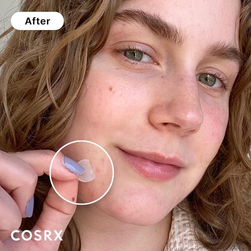 Cosrx Master Patch Original Fit - Pansement efficace anti-acné - 2 x Pack