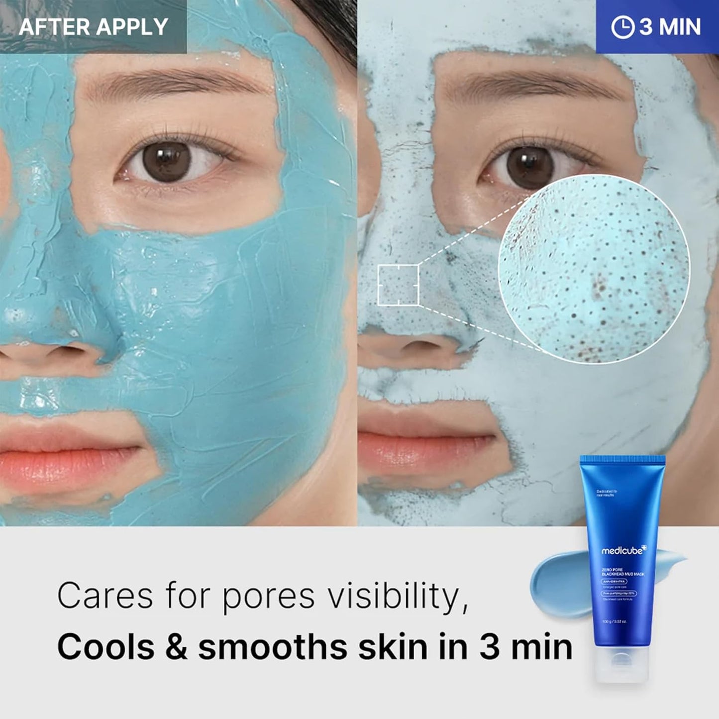 Medicube Zero Pore Blackhead Mud Mask - 100g