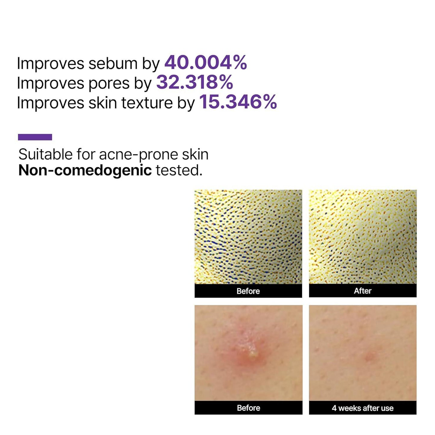 Some By Mi Retinol Intense Reactivating Serum - 30ML