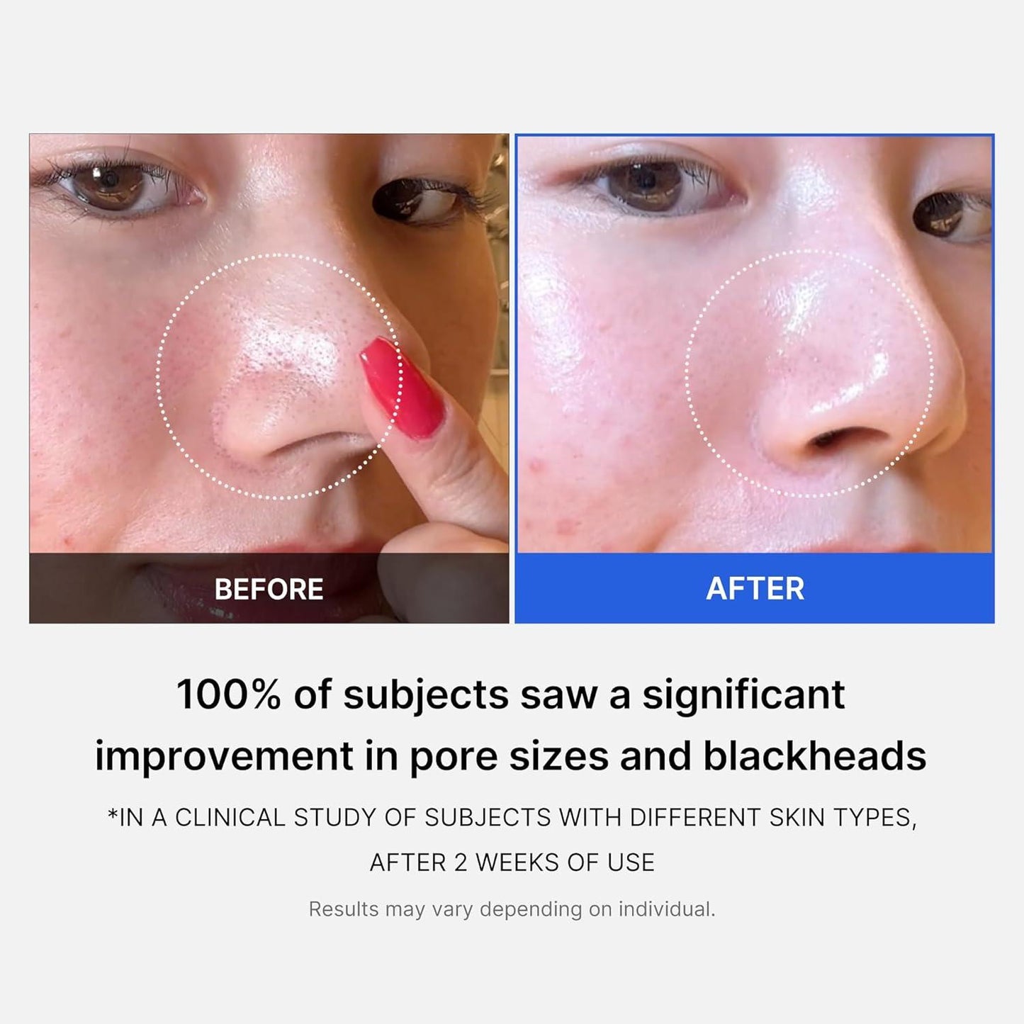 Medicube ZERO PORE PAD 2.0 - 70pcs