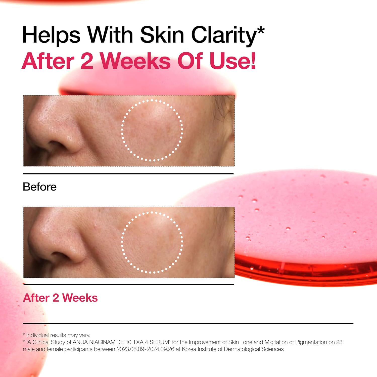 Anua [RENEW] Niacinamide 10% + Txa 4% Dark Spot Correcting Serum - 30 ml