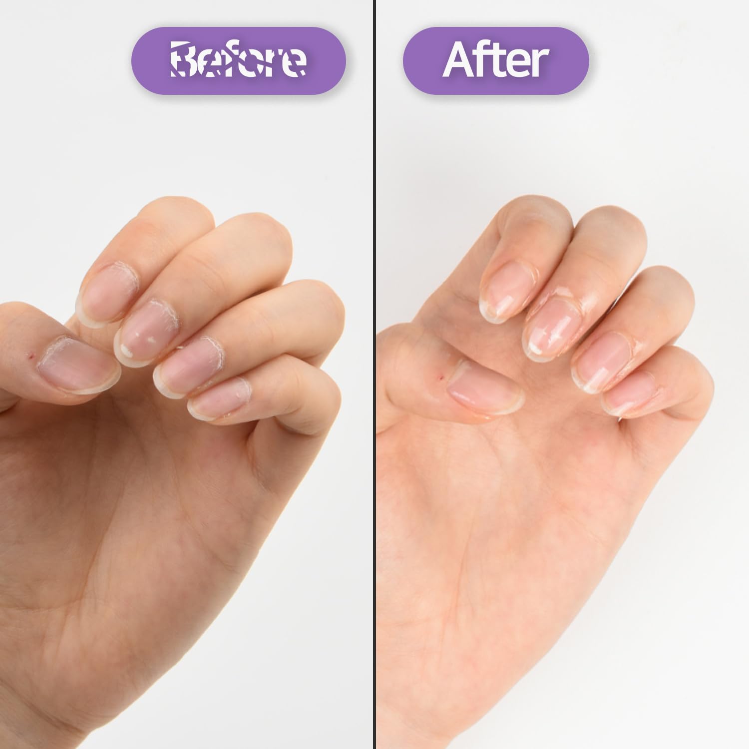 Baren Nail and Cuticle Care Essence Oil Pen - 2ml