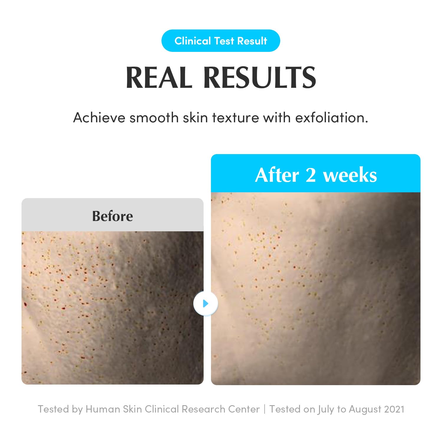 EQQUALBERRY Daily Peeling Swimming Pool Toner - 300ml