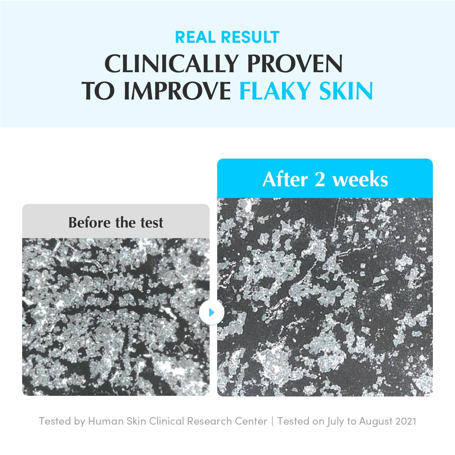 EQQUALBERRY Daily Peeling Swimming Pool Toner - 300ml