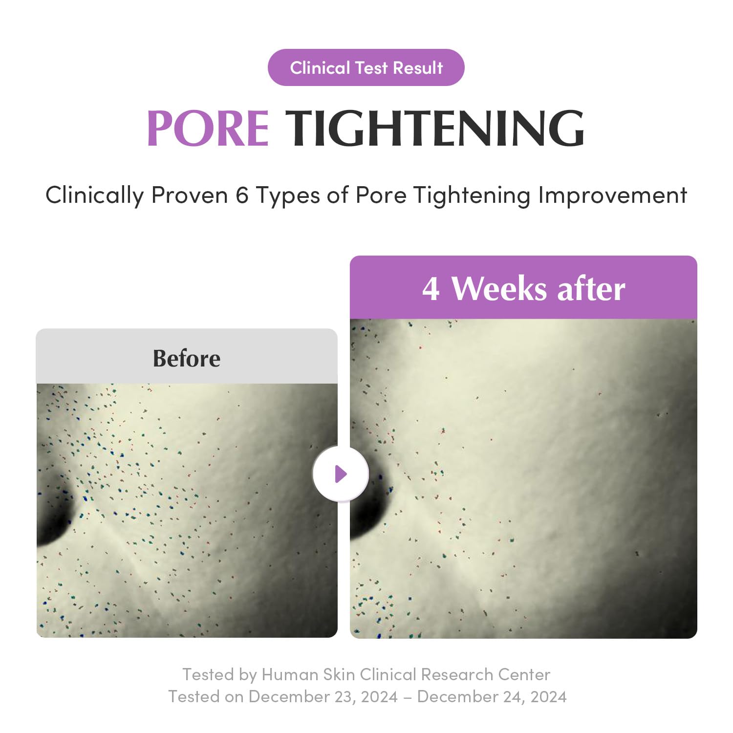 EQQUALBERRY Purple PDRN Pore Minimizing Serum - 30ml