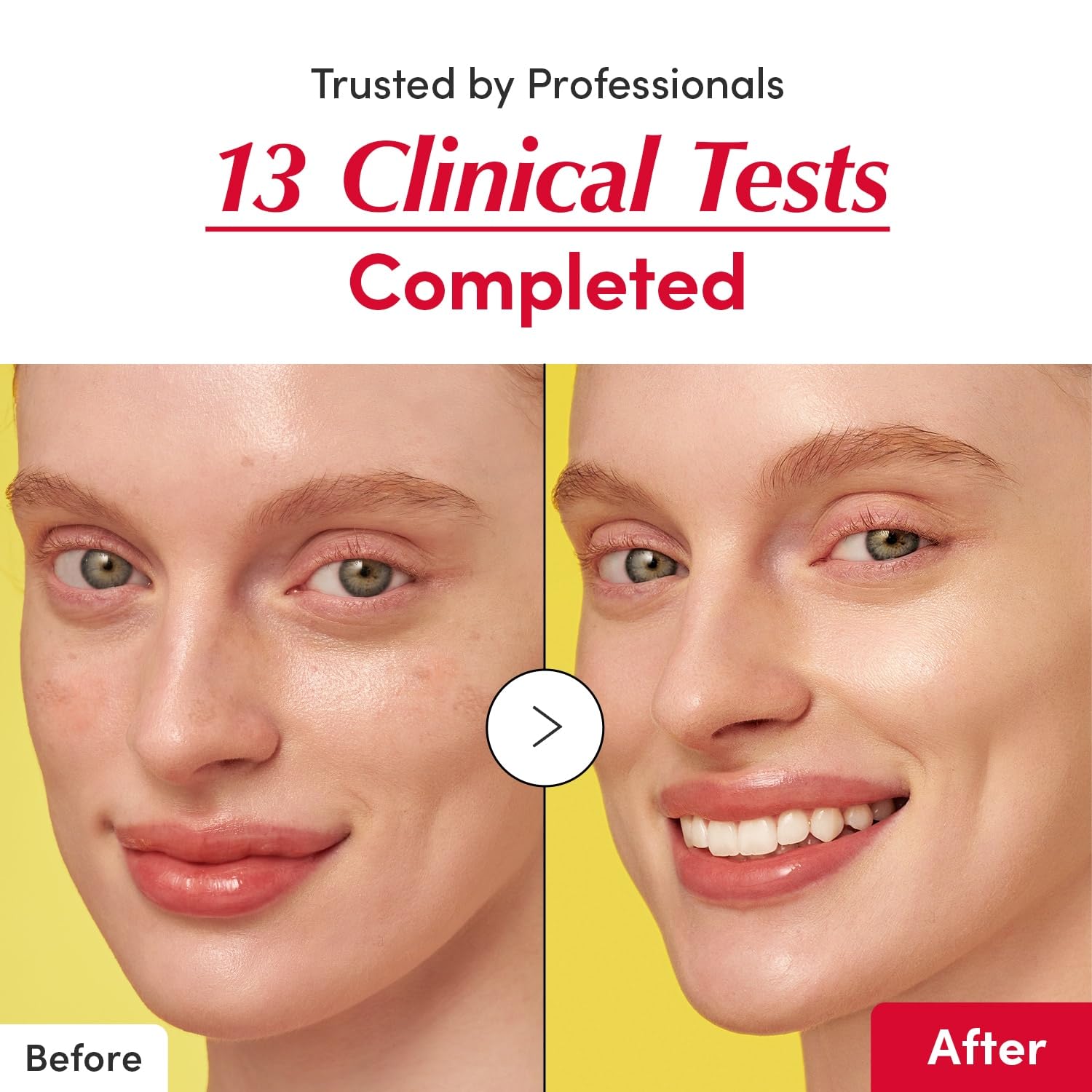 EQQUAL BERRY Vitamin Illuminating Serum - 30ML