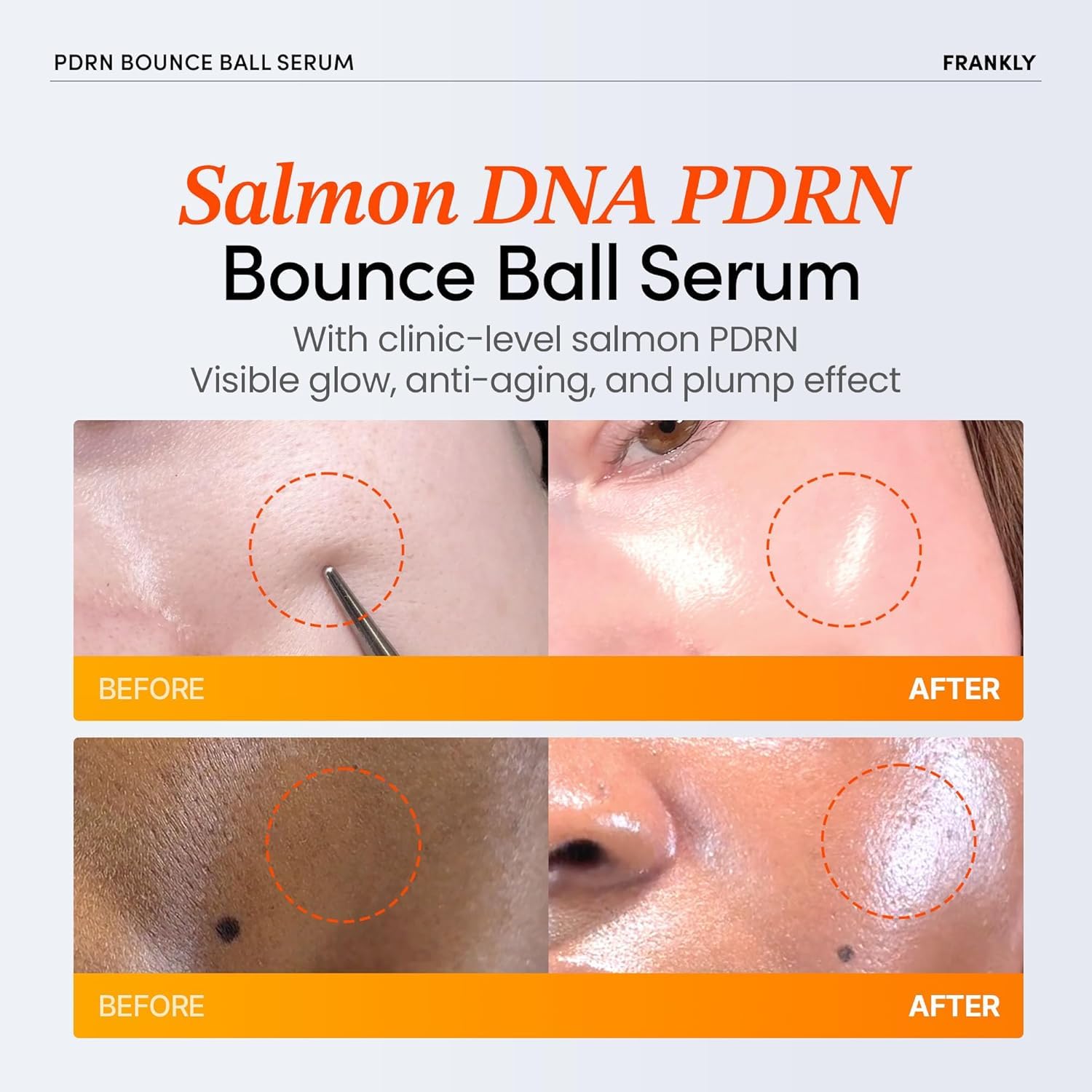 Frankly PDRN Bounce Ball Serum - 30ml