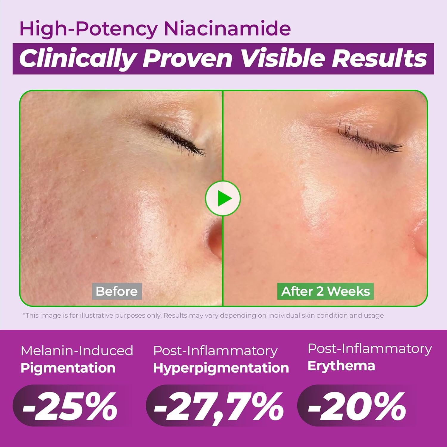 Jumiso Niacinamide 20 Serum - 40ml