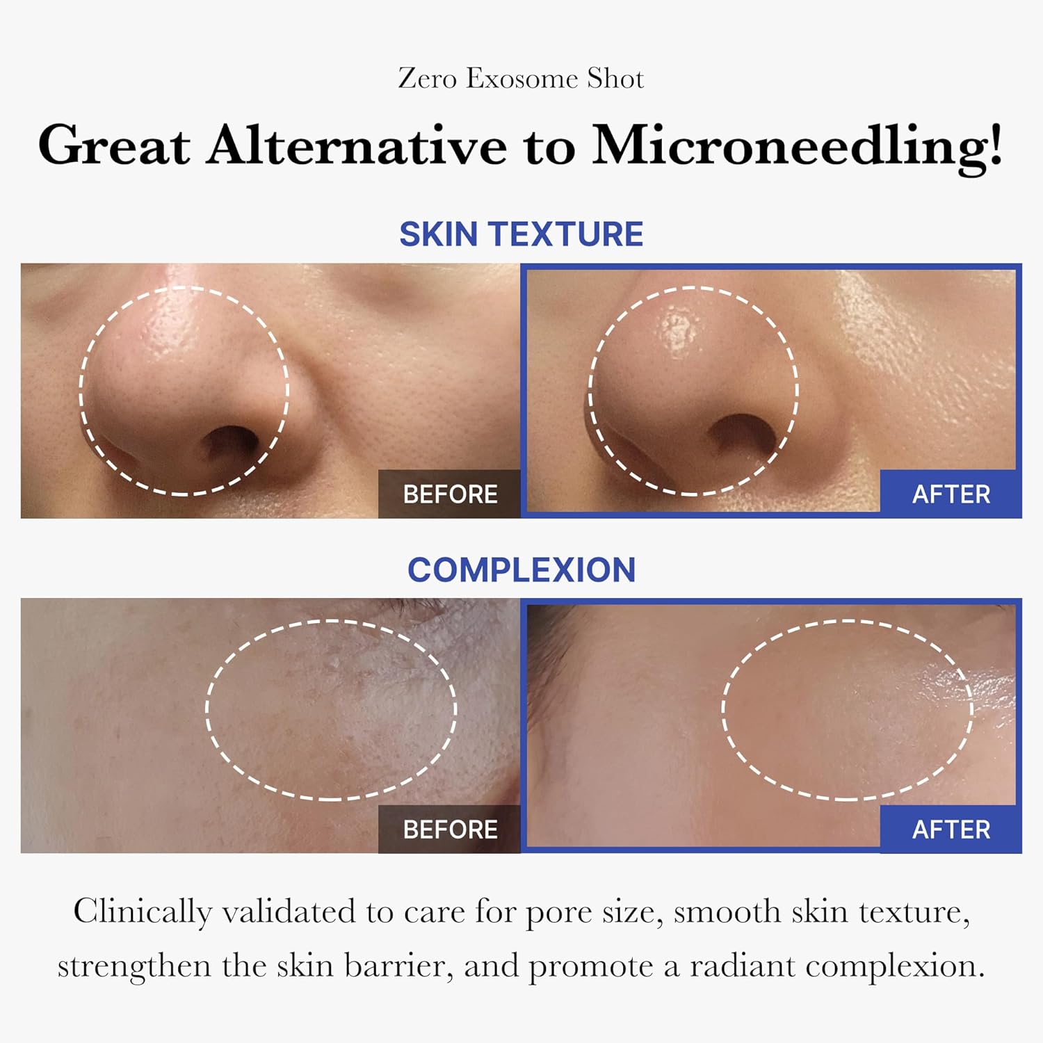 Medicube One Day Exosome Shot Pore Ampoule 2000 - 30ml