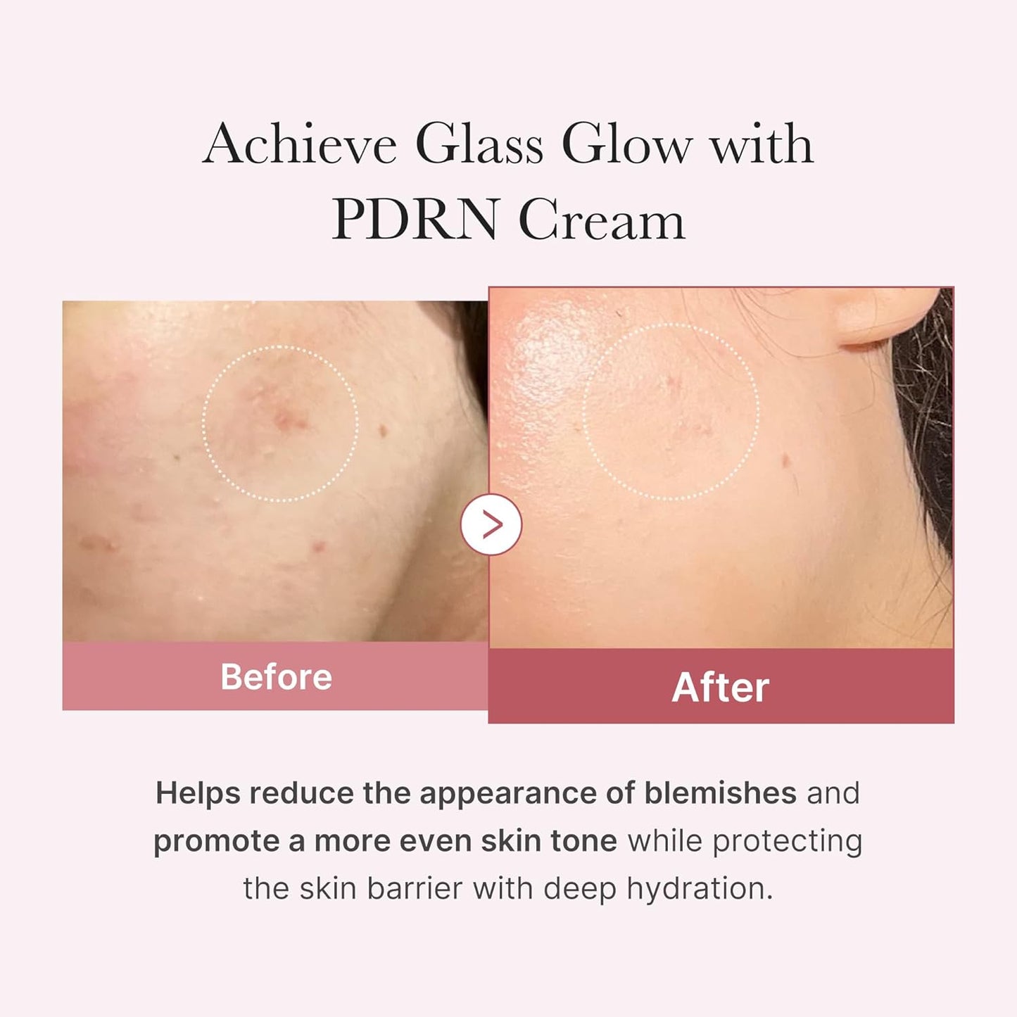 Medicube PDRN Pink Hyaluronic MoisturIzing Cream - 50ML