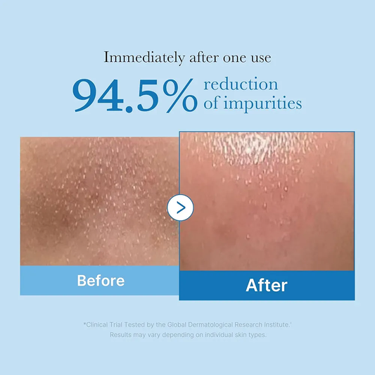 Medicube Zero Pore Blackhead Deep Cleansing Oil - 205ml
