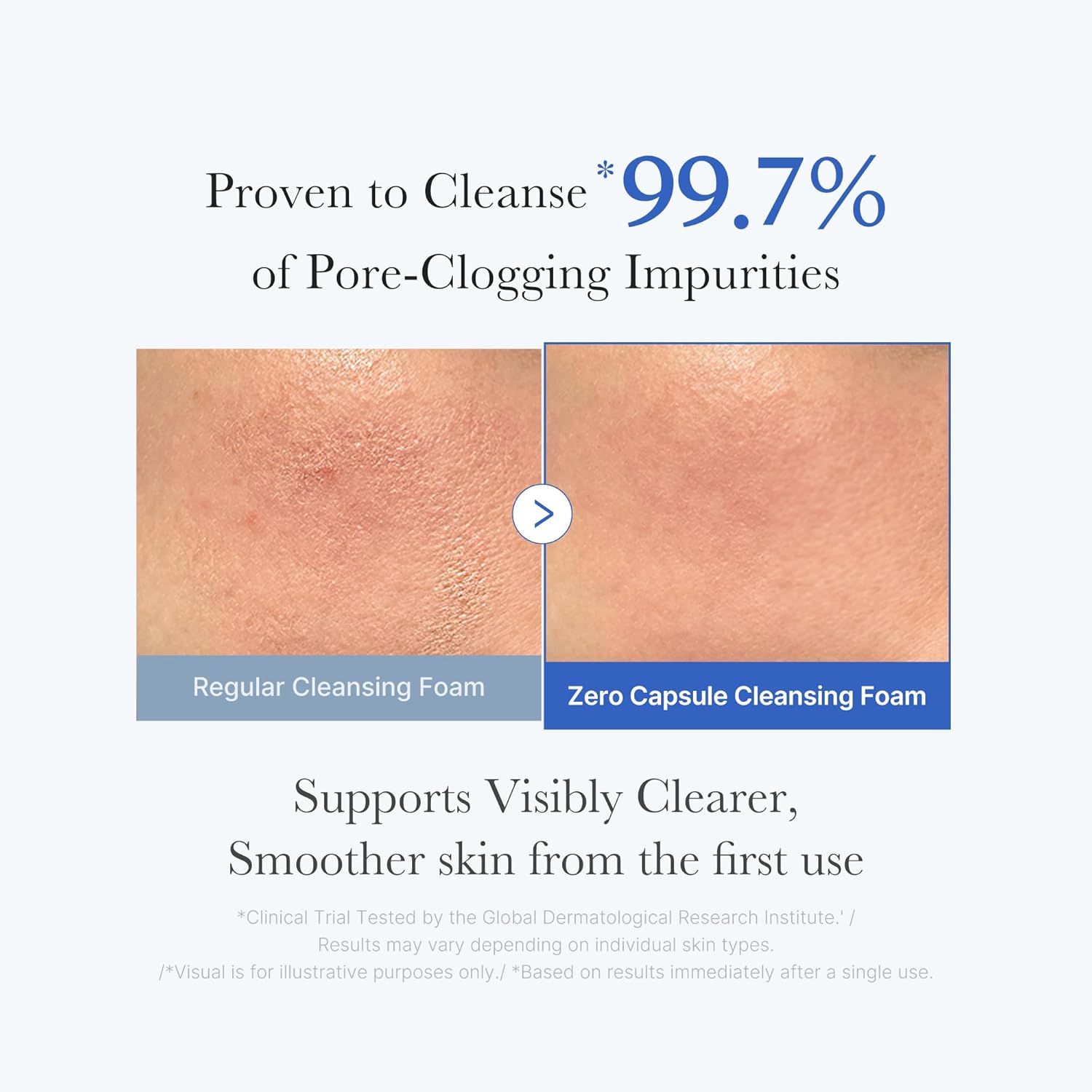 Medicube Zero Pore SA Clear Capsule Cleansing Foam - 120g